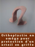 orthoplastie Lyon